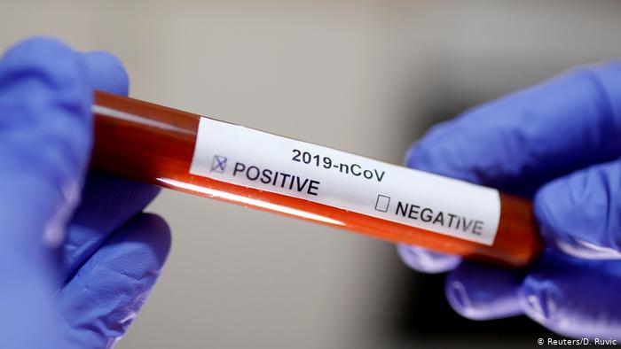 Prioriteti za testiranje na SARS-CoV-2