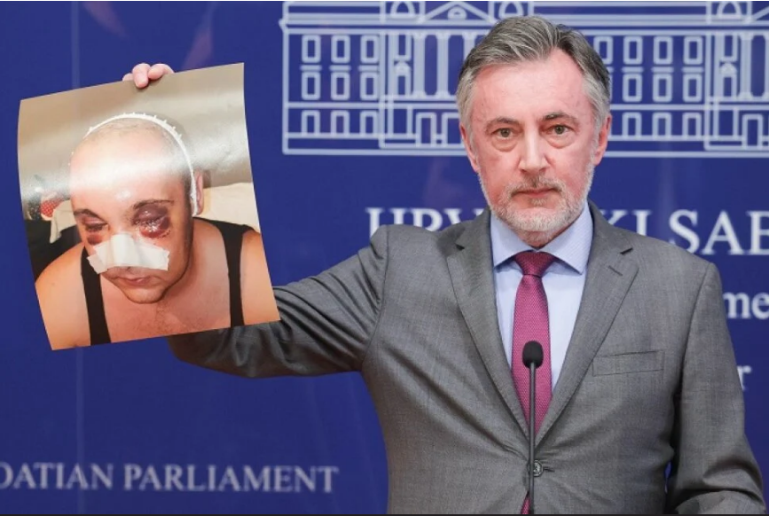 Priveden trojac koji je pretukao 28-godišnjaka jer je naručio Škorinu pjesmu, jednom od njih pronađen i automatski pištolj
