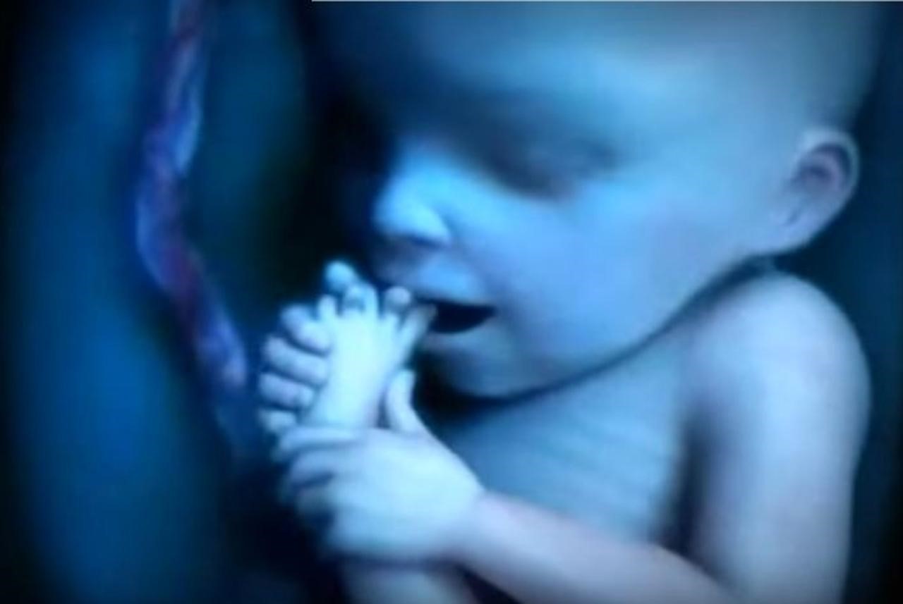 AKO JE UBIJANJE NAJRANJIVIJIH MEĐU NAMA "PRAVO IZBORA", NA DNU SMO - NIŽE SE NE MOŽE