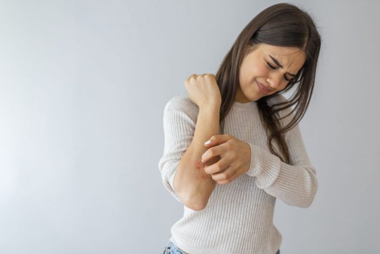 29. listopada Svjetski dan borbe protiv psorijaze – dan plemenitih ciljeva za pomoć oboljelima